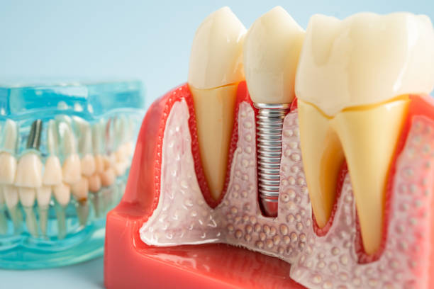 Best Emergency Dental Care  in Madrid, IA